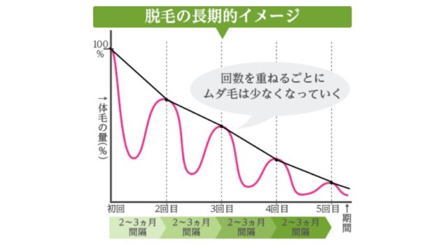 チョコザップ　脱毛期間